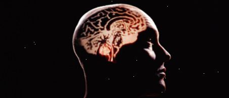 עובדות מוח ומערכת עצבים